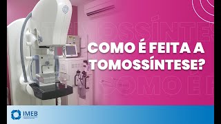 Como é feita a Tomossíntese Mamografia 3D  IMEB [upl. by Palila171]