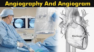 What is Angiography and Angiogram  How Angiography is performed 3D Animation [upl. by Tierza]