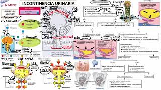 Urología  2 RM19 2V UROLOGIA INCONTINENCIA URINARIA de Qx Medic on Vimeo [upl. by Titania]