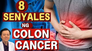 8 Senyales ng Colon Cancer  Payo ni Doc Willie Ong Internist and Cardiologist [upl. by Larrabee]