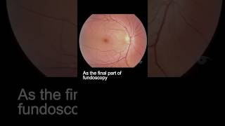 Examining the fundus – part 3 ophthalmology [upl. by Dawn]