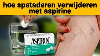 Spataderen verdwenen op de 7e dag neem aspirine en [upl. by Eneleh]