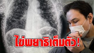 ชายไอต่อเนื่อง หาหมอพบไข่พยาธิตัวตืดเต็มตัว จนกลายเป็นหินปูนเกาะร่างกาย [upl. by Knute]