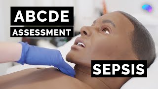 ABCDE Assessment  Sepsis  Emergency Simulation Scenario  OSCE Guide  UKMLA  CPSA [upl. by Nylzor500]