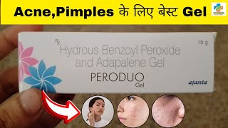 Peroduo Gel Use in Hindi  Benzoyl peroxide amp Adapalene Gel Use  Acne  pimples  SK MEDICINE [upl. by Uriel]