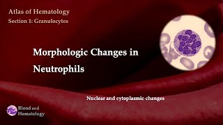 Morphologic Changes in Neutrophils nuclear and cytoplasmic changes [upl. by Shu]