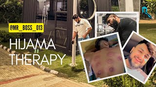 HIJAMA THERAPYMUSCLES RECOVERY💪TRICEP WORKOUT [upl. by Choo]