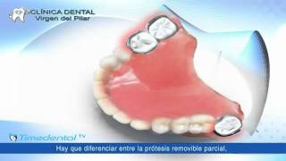 ¿Qué es una prótesis dental removible por Clínica Dental Virgen del Pilar [upl. by Airtemed]