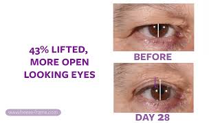 Nonsurgical EYELID LIFT upper eyelid lifting serum [upl. by Gaylene]