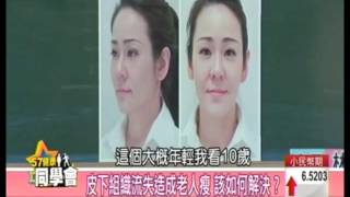 【Ellansé洢蓮絲】改善雙頰太陽穴凹陷下垂 重回緊緻膨潤少女臉蛋 五七健康同學會片段 [upl. by Renaud]