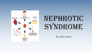 Nephrotic syndrome  causes clinical presentation investigation treatment staging [upl. by Laveen]