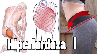 Pogłębiona lordoza lędźwiowa ból pleców  JAK SKORYGOWAĆ cz1 Anatomia [upl. by Anelrihs328]