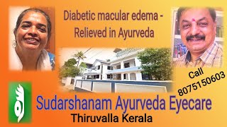 Mylapra Diabetic Macular edema vision improved in AyurvedaA Sudarshanam story [upl. by Cordi]