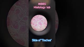 Histology lab 🔬 Best slide of Trachea tissue  MBBS life 🥼 youtubeshorts mbbs neet [upl. by Ntsud]