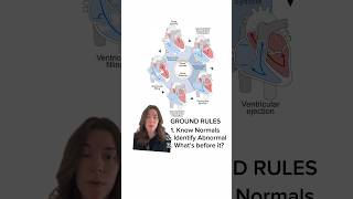 HEMODYNAMICS  how to understand it all Step by Step hemodynamics leftheartcath rightheartcath [upl. by Fai]