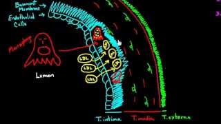 Atherosclerosis  Part 1 [upl. by Roby]