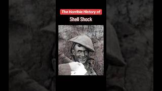 The Shocking History of “Shell Shock” [upl. by Ainesell]