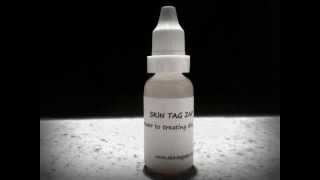 Skin Tag Remover  removing skin tags the natural way Skin Tag Zap [upl. by Mannuela919]