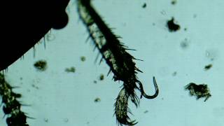 A Termite and its Pests Mites and Nematodes [upl. by Nonnaehr]