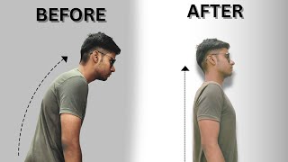 Bura Posture Aapko Maar Sakta Hai  Improve You Posture [upl. by Namyh]