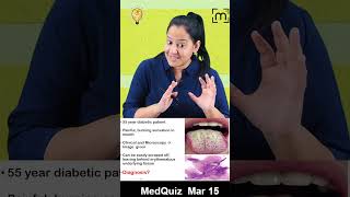 Medquiz 15 March [upl. by Aihsele583]