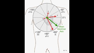 Determination of Mean QRS Axis in Electrocardiography [upl. by Norm910]