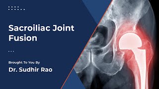 SI Joint Fusion for SI Joint Dysfunction  A Minimally Invasive Procedure [upl. by Wernick]