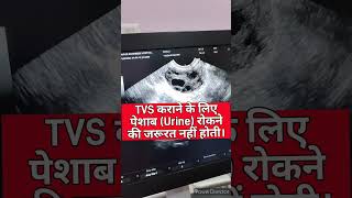 TVS सोनोग्राफी के क्या क्या फायदे हैं TVSTransvaginal sonography sonography ultrasound viral [upl. by Neom91]