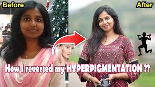 How I reversed my HYPERPIGMENTATION   drsharmika hyperpigmentation skincare cure [upl. by Yanffit927]