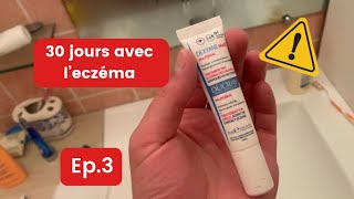 Eczema  Ma routine du soir  Sel de la mer morte Paupières Relaxation  Jours 4 et 5 [upl. by Isa518]