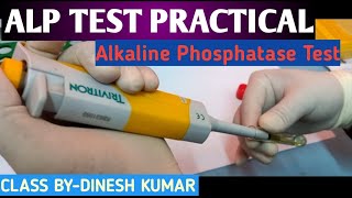 ALP Alkaline Phosphatase Test practical video in hindi [upl. by Gettings]