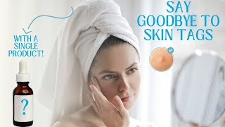 Skin Tag Removal  Causes and Treatment [upl. by Pallas381]