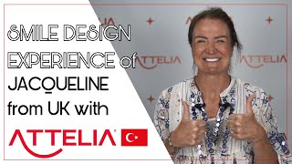 JACQUELINES SMILE DESIGN EXPERIENCE WITH ATTELIA DENTAL [upl. by Beeck]