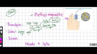 How Pulse oximetry or Plethysmography is donePrinciples cause of false results [upl. by Akinot350]