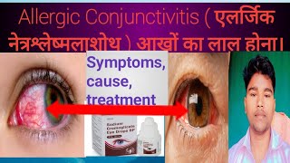 Allergic Conjunctivitis  एलर्जिक नेत्रश्लेष्मलाशोथ Abhia2zmedicalSymptoms cause treatment [upl. by Emmet]