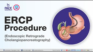 What is ERCP Test and How it is done  Department of Gastroenterology  Pace Hospitals [upl. by Clovah718]