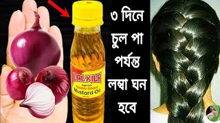 ৩ দিন এটা লাগাও চুল পড়া বন্ধ হবে চুল ঘন লম্বা কালো হবে নতুন চুল গজাবেhair growth remedies [upl. by Albers]