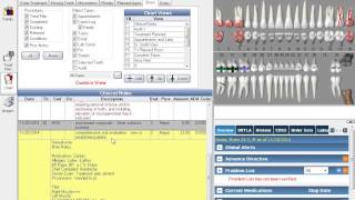 Open Dental Clinical Training for eClinicalWorks Users [upl. by Uzziel737]