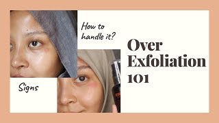 SIGNS OF OVER EXFOLIATION  How to fix over exfoliation [upl. by Aelyk]