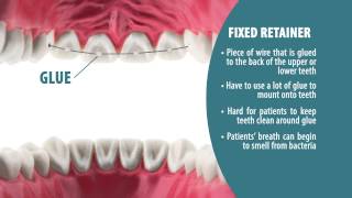 Types of Retainers  Retainer Wear Part 2 [upl. by Leroy]