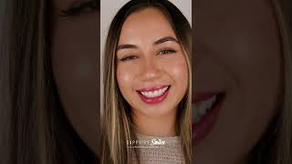 Minimal vs No Prep Veneers Explained [upl. by Winwaloe]