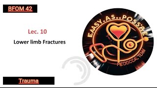 Lecture 10  Lower Limb Fractures  Trauma 42 [upl. by Kcirret183]