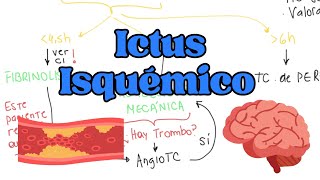 ICTUS ISQUÉMICO Estrategias de Manejo y Tratamiento [upl. by Otsedom910]