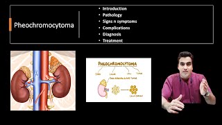 PHEOCHROMOCYTOMAINTRODUCTION ETIOLOGY PATHOPHYSIOLOGY SIGNS amp SYMPTOMS DIAGNOSIS MANAGEMENT [upl. by Anaujat]