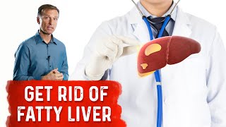 Reduce Your Liver Fat by 50 Percent in 14 Days [upl. by Llener]