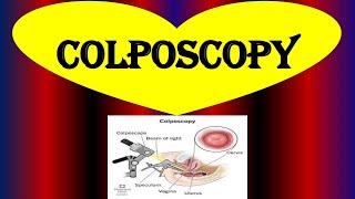 What is a Colposcopy  Colposcopy  Biopsy Purpose Procedure Risks and Results [upl. by Adina423]