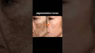 Remove pigmentation face toner 😘viralvideo faseeha amp Fatima subscribe [upl. by Burke]