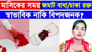 মাসিকের সময় জমাট বাঁধা রক্ত কেন আসে কিসের লক্ষণ এবং চিকিৎসা। [upl. by Nnaeiram58]