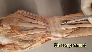 Extensor Retinaculum of the HandWrist [upl. by Dowell501]