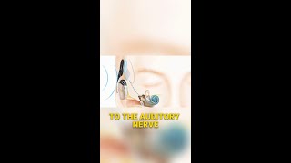 How Cochlear Implants Restore Hearing [upl. by Dowzall130]